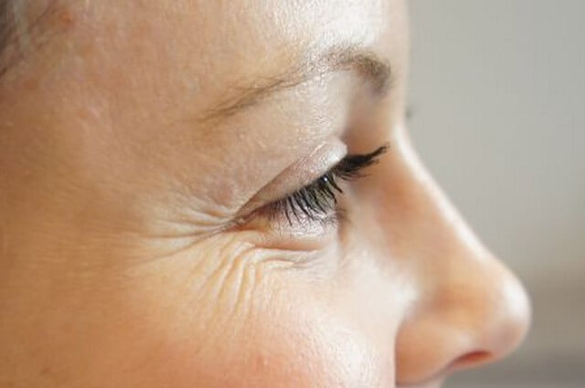 Dermatoestetica